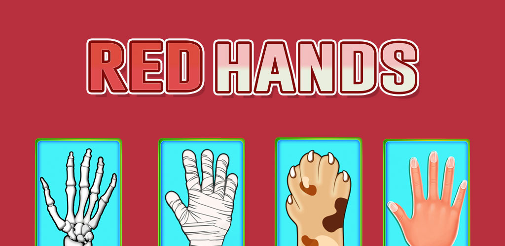 Slap Hands: Red Hands Multiplayer Game. Challenge friends in intense Red Hands slapping battles